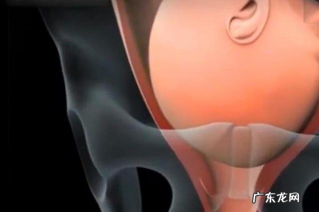 顺产分娩的全部步骤-自然顺产分娩