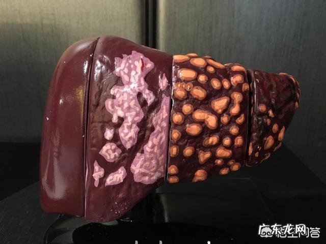 日常生活中有什么不好习惯会导致皮肤变差?