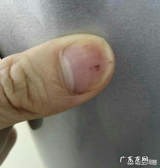 日常生活中有什么不好习惯会导致皮肤变差?