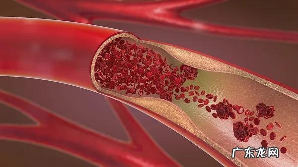新陈代谢太快太慢都有疾病风险!标准怎么算看这里→