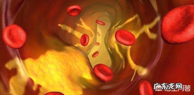 减肥反而低密度脂蛋白升高 减肥低密度脂蛋白高怎么办？