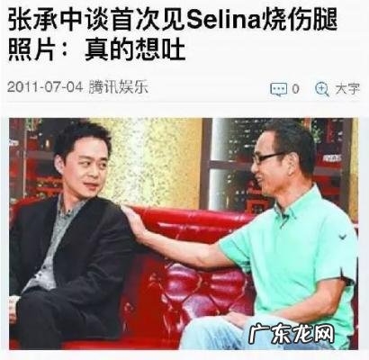 selina烧伤原因 selina是谁