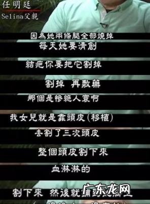 selina烧伤原因 selina是谁