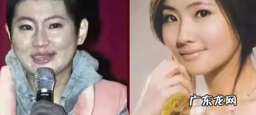 selina烧伤原因 selina是谁