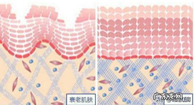 长期使用瘦脸仪会有效果吗？