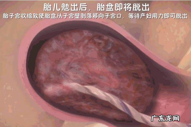 婴儿是怎样分娩出来的-分娩婴儿从哪里出来