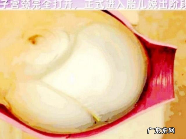 顺产疼痛过程-跪式顺产疼痛难忍