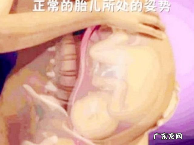 顺产疼痛过程-跪式顺产疼痛难忍