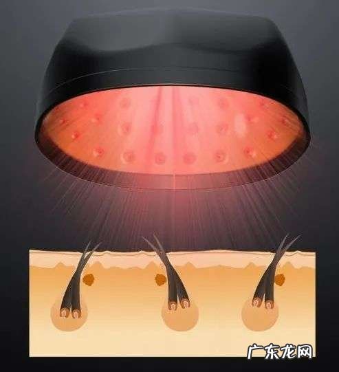 你的脱发焦虑,成就他人的秃头生意