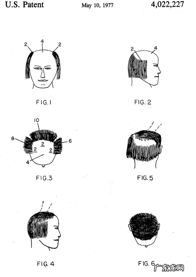 你的脱发焦虑，成就他人的秃头生意