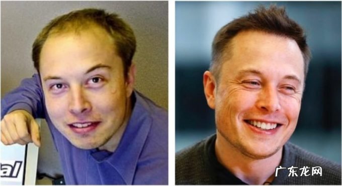 你的脱发焦虑,成就他人的秃头生意