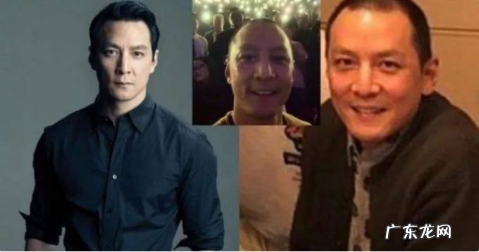 你的脱发焦虑,成就他人的秃头生意