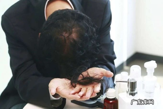 你的脱发焦虑,成就他人的秃头生意