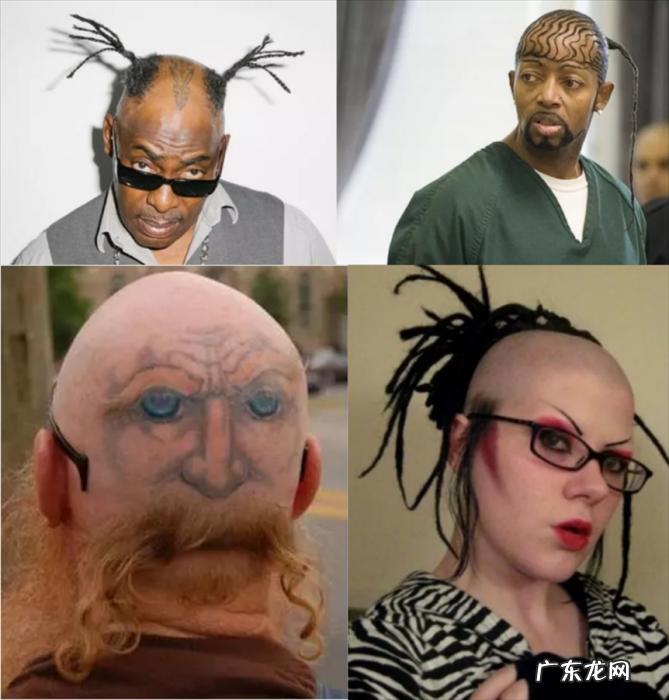 你的脱发焦虑，成就他人的秃头生意