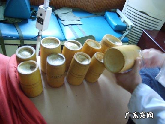 拔罐减肥对更年期有影响吗？