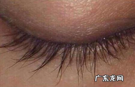 怎么可以快速长睫毛 怎么可以使睫毛变长