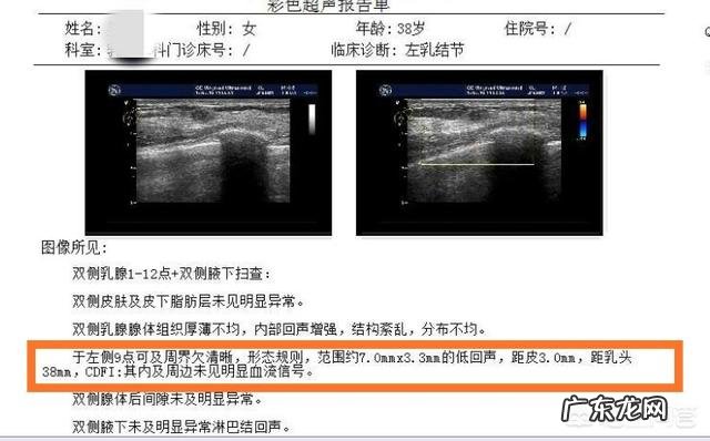 乳腺增生和结节,可以每天热敷缓解吗?