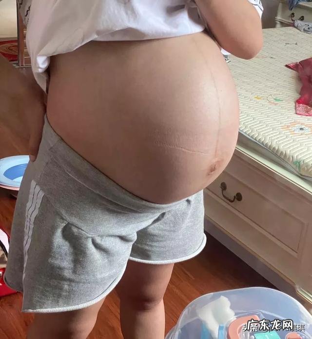 顺产后盆骨宽,屁股大,产后如何盆骨修复,半年时间减脂32斤?