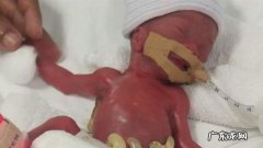 世界上最小的婴儿存活-世界上最小的婴儿玩具