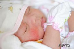 新生儿五种问题新手妈妈早知道-新生儿生殖问题