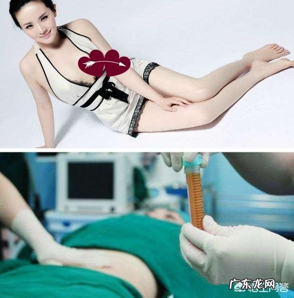 抽脂怎么可以不反弹 抽脂风险有多大?有什么减脂方法可以规避这些风险?