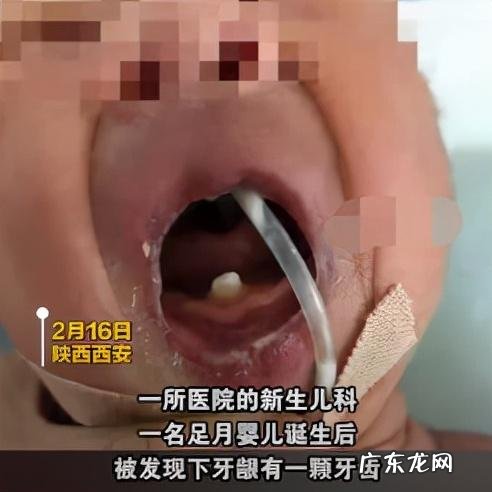 宝宝20个月才长上下4颗牙齿-宝宝10个月才长4颗牙齿