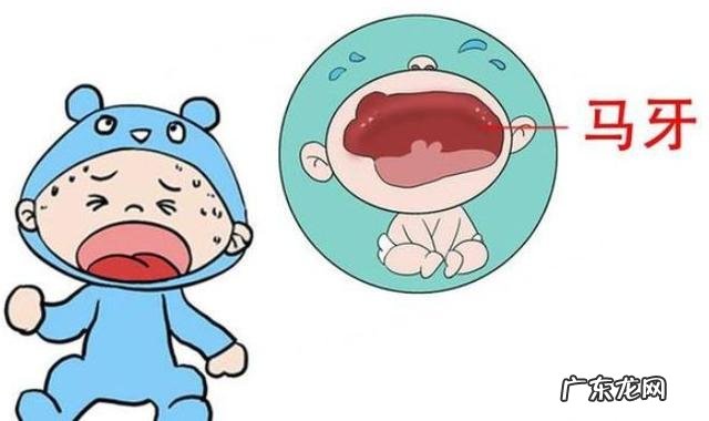 宝宝20个月才长上下4颗牙齿-宝宝10个月才长4颗牙齿