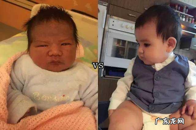 新生儿最丑的4个地方-刚出生的婴儿最丑的地方