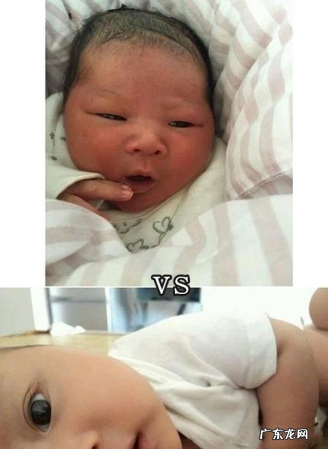 新生儿最丑的4个地方-刚出生的婴儿最丑的地方