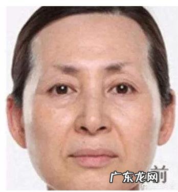 脸上长痘痘适合吃什么食物?