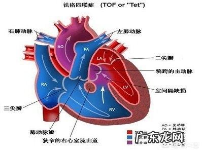 先心病能活多少岁 得了先天性心脏病能活多久？