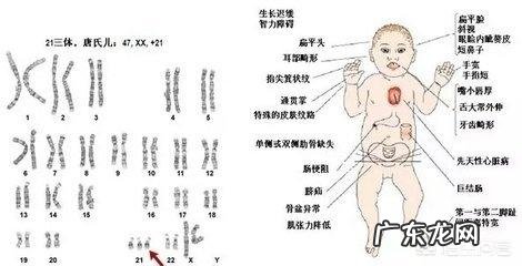 先心病能活多少岁 得了先天性心脏病能活多久？