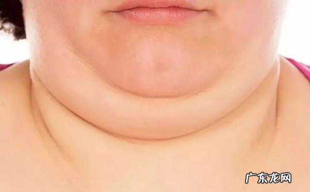 千万别让脖子粗过这个数,否则很危险!赶紧量一下……