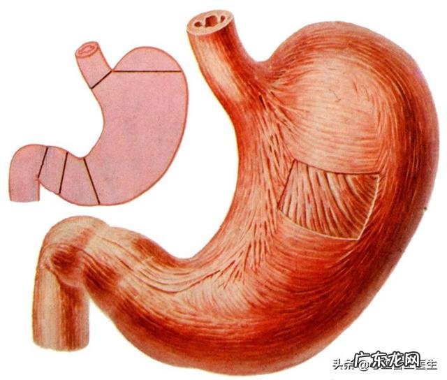 阿司匹林可以像保健品一样经常吃吗,为什么?