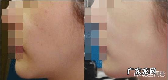 30岁女性脸色有点黄，带孩子睡不好眼袋大，用什么护肤品？