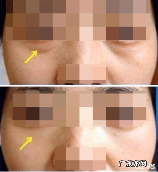 30岁女性脸色有点黄，带孩子睡不好眼袋大，用什么护肤品？