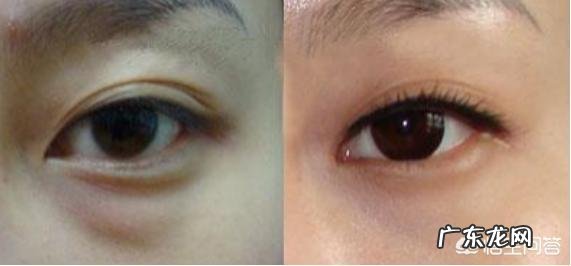 30岁女性脸色有点黄，带孩子睡不好眼袋大，用什么护肤品？