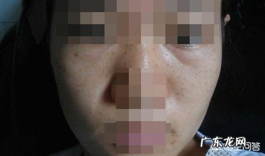 30岁女性脸色有点黄，带孩子睡不好眼袋大，用什么护肤品？