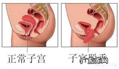 生产完月子里可以穿收腹衣吗？是否真的有利于身体恢复还能瘦身？