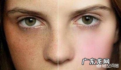 有什么好的办法可以清除脸上的黄褐斑？