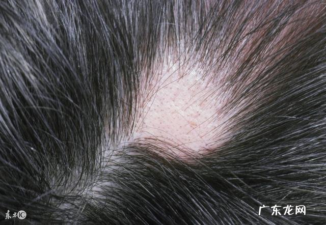 生完孩子以后，变胖，腰疼，长白发，长斑，还长痔疮，老了吗？