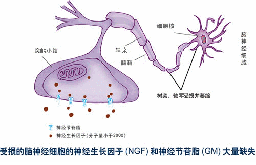 产后修复,是去产后康复中心修复好还是通过瑜伽修复更好?