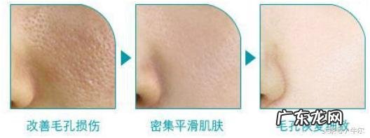 让脸部毛孔变细,你用过最有效的办法是什么?