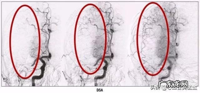 天气太冷广场舞大妈\"转战\"地下车库跳舞,对此你怎么看?