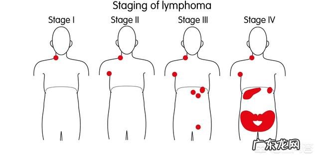 9岁男孩不幸患上直肠癌晚期,我们该反思些什么?