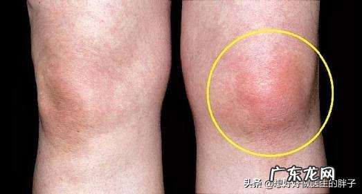 运动会降低血压和血脂吗?