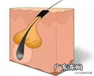 脸上疯狂长痘，是不是螨虫已经成堆了？怎么才能祛痘啊？