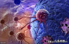 坏习惯是癌症找上门的捷径吗？