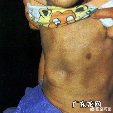 怎么分清骨痛与骨转移 什么样的疼痛应该警惕是骨转移?