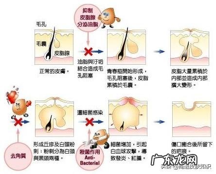 26岁了，脸上的痘痘还叫青春痘吗？
